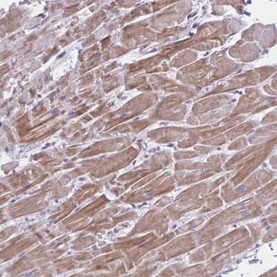 Immunohistochemistry-Paraffin: NIR2 Antibody [NBP2-34132]