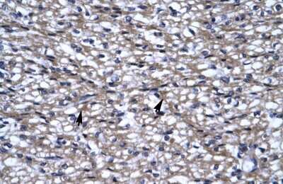 Immunohistochemistry: NIRF Antibody [NBP2-86734]