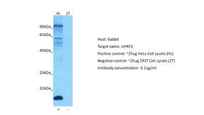 Western Blot: NIRF Antibody [NBP2-86734]