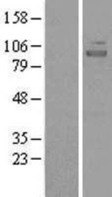 Western Blot: NIRF Overexpression Lysate [NBL1-17604]