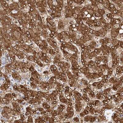 Immunohistochemistry-Paraffin: NIT2 Antibody [NBP1-89486]