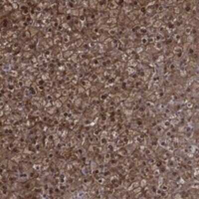 Immunohistochemistry-Paraffin: NIT2 Antibody [NBP3-17403]