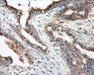 Immunohistochemistry: NIT2 Antibody (OTI2B9) - Azide and BSA Free [NBP2-72995]