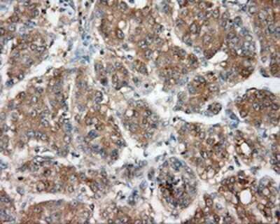 Immunohistochemistry: NIT2 Antibody (OTI2B9) - Azide and BSA Free [NBP2-72995]