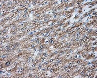 Immunohistochemistry: NIT2 Antibody (OTI2B9) - Azide and BSA Free [NBP2-72995]