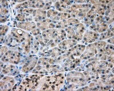 Immunohistochemistry: NIT2 Antibody (OTI2B9) - Azide and BSA Free [NBP2-72995]