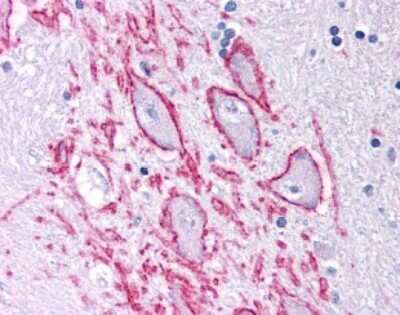 Immunohistochemistry: NK1R Antibody - BSA Free [NB300-119]