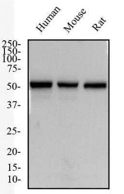 Western Blot: NK1R AntibodyBSA Free [NB300-119]