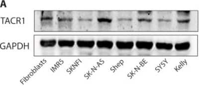 Western Blot: NK1R AntibodyBSA Free [NB300-119]