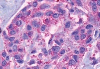 Immunohistochemistry: NK2R Antibody [NBP3-14421]