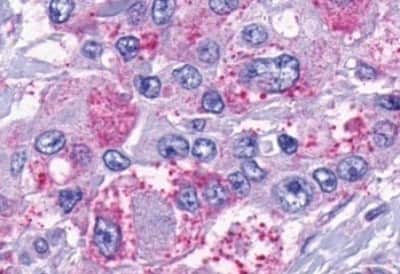 Immunohistochemistry-Paraffin: NK2R Antibody [NBP3-14421]