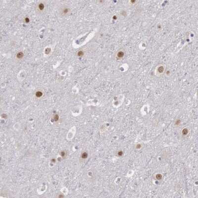 Immunohistochemistry-Paraffin: NKAP Antibody [NBP1-82117]