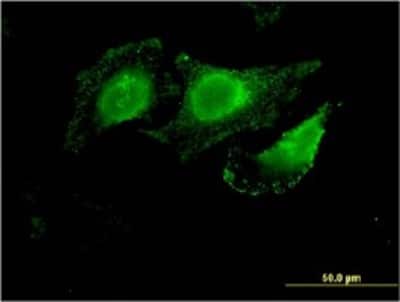 Immunocytochemistry/ Immunofluorescence: NKCC1/SLC12A2 Antibody (5H7) [H00006558-M01]