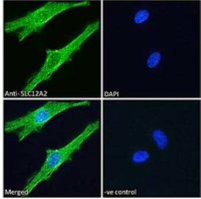 Immunofluorescence: NKCC1/SLC12A2 Antibody [NBP1-52148]
