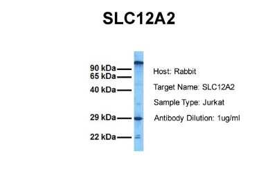 Western Blot: NKCC1/SLC12A2 Antibody [NBP1-59430]