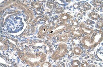 Immunohistochemistry: NKCC2/SLC12A1 Antibody [NBP1-57622]