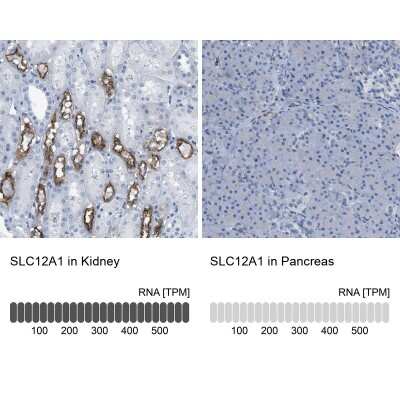 Immunohistochemistry-Paraffin: NKCC2/SLC12A1 Antibody [NBP1-82559]