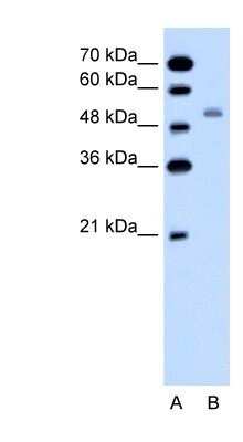 Western Blot: NKCC2/SLC12A1 Antibody [NBP1-57622]