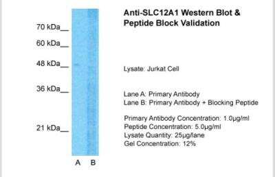 Western Blot: NKCC2/SLC12A1 Antibody [NBP1-57622]