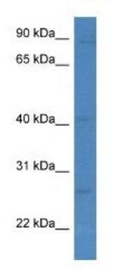 Western Blot: NKG2A/CD159a/KLRC1 Antibody [NBP1-74093]