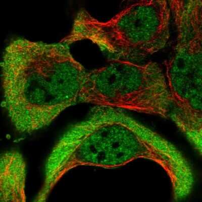 Immunocytochemistry/ Immunofluorescence: NKTR Antibody [NBP1-82459]