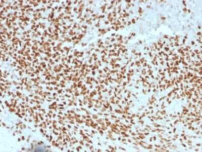 Immunohistochemistry-Paraffin: NKX2.2 Antibody (NX2/1523) [NBP2-53200]