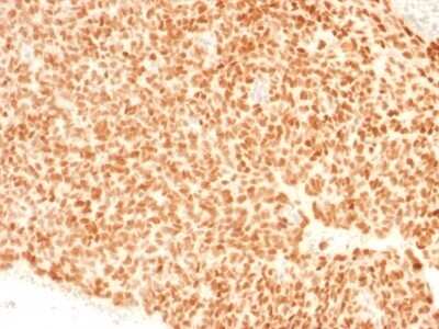 Immunohistochemistry-Paraffin: NKX2.2 Antibody (NX2/1523) [NBP2-53200]