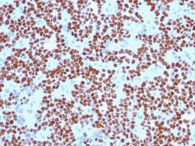 Immunohistochemistry-Paraffin: NKX2.2 Antibody (NX2/294) - Azide and BSA Free [NBP2-33058]