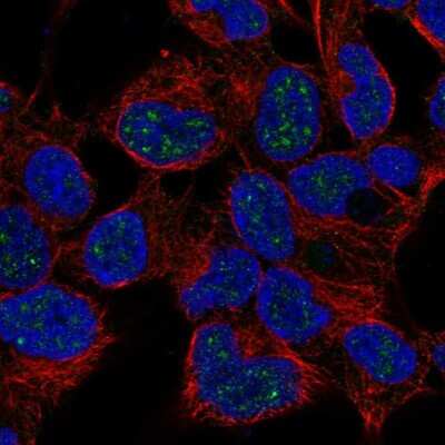 Immunocytochemistry/ Immunofluorescence: NKX2-4 Antibody [NBP2-57854]