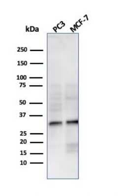 Western Blot: NKX2.8 Antibody (NKX28/3233R) [NBP3-07637]