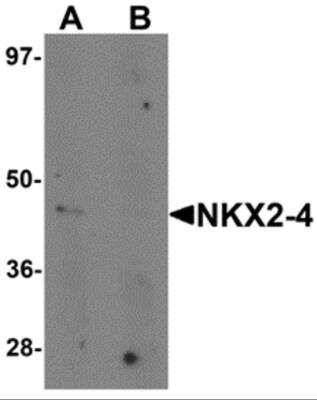 Western Blot: NKX2-4 AntibodyBSA Free [NBP2-81760]