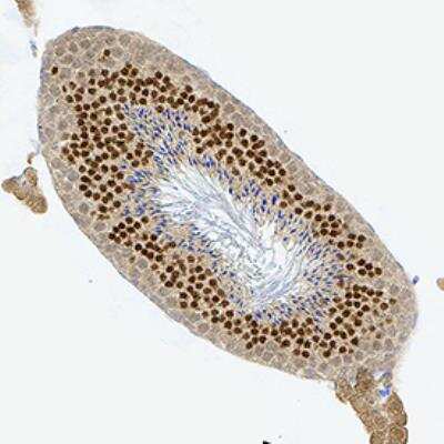 Immunohistochemistry-Paraffin: NKX3.1 Antibody (0361) - BSA Free [NB100-1828]