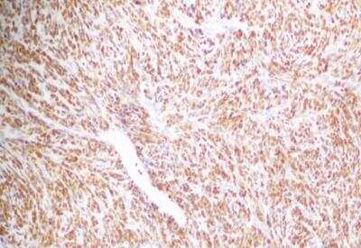 Immunohistochemistry-Paraffin: NKX3.1 Antibody (0361) - BSA Free [NB100-1828]