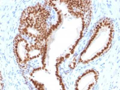 Immunohistochemistry-Paraffin: NKX3.1 Antibody (NKX3.1/2576) [NBP2-79736]