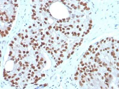 Immunohistochemistry-Paraffin: NKX3.1 Antibody (NKX3.1/3350) [NBP3-07411]