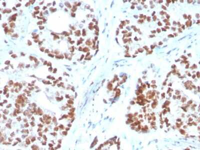 Immunohistochemistry-Paraffin: NKX3.1 Antibody (NKX3.1/3350) - Azide and BSA Free [NBP3-08572]