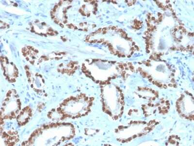 Immunohistochemistry-Paraffin: NKX3.1 Antibody (NKX3.1/4562R) - Azide and BSA Free [NBP3-08744]
