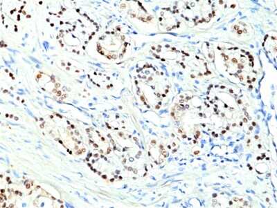 Immunohistochemistry-Paraffin: NKX3.1 Antibody (RM430) [NBP3-09180]