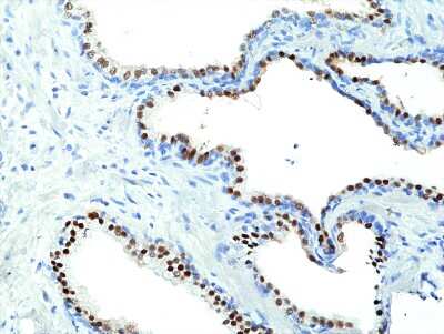 Immunohistochemistry-Paraffin: NKX3.1 Antibody (RM430) [NBP3-09180]