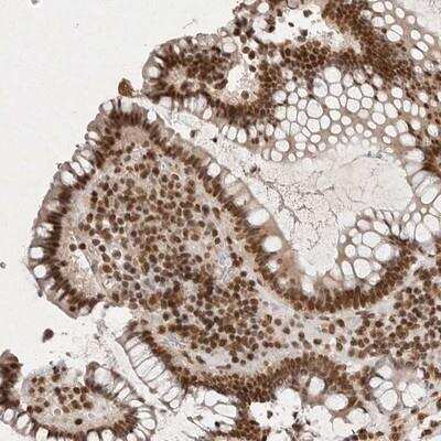 Immunohistochemistry-Paraffin: NKX3-2 Antibody [NBP1-88708]