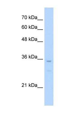 Western Blot: NKX3-2 Antibody [NBP1-80213]