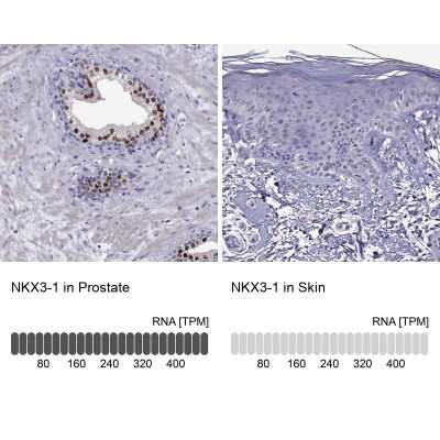 Immunohistochemistry-Paraffin: NKX3.1 Antibody [NBP2-62726]