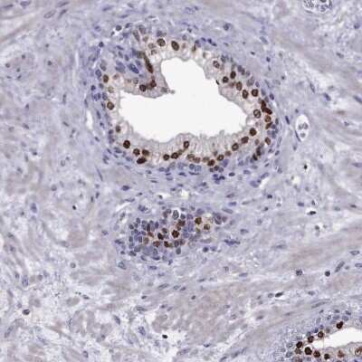 Immunohistochemistry-Paraffin: NKX3.1 Antibody [NBP2-62726]