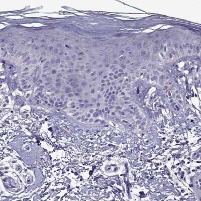 Immunohistochemistry-Paraffin: NKX3.1 Antibody [NBP2-62726]