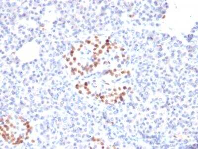 Immunohistochemistry-Paraffin: NKX6.1 Antibody (NKX61/2561) - Azide and BSA Free [NBP2-79872]
