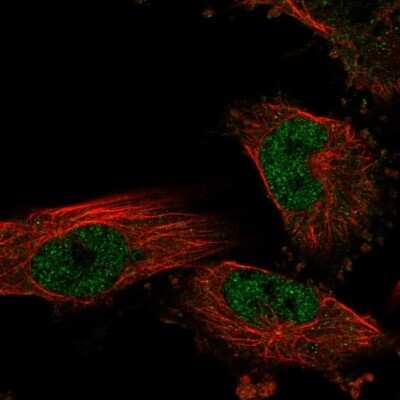 Immunocytochemistry/ Immunofluorescence: NKX6.1 Antibody [NBP1-82553]