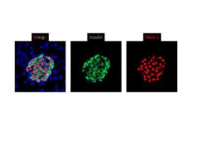 Immunohistochemistry-Frozen: NKX6.1 Antibody - BSA Free [NBP1-49672]