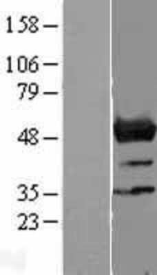 Western Blot: NLE1 Overexpression Lysate [NBL1-13664]