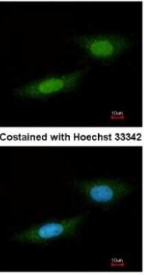 Immunocytochemistry/ Immunofluorescence: NLK Antibody [NBP1-32264]