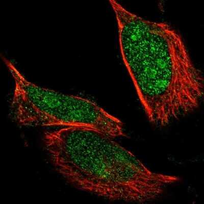Immunocytochemistry/ Immunofluorescence: NLK Antibody [NBP1-86047]